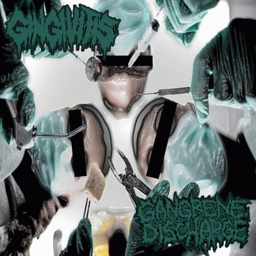 Gangrene Discharge : Gangrene Discharge - Gingivitis